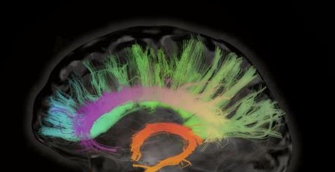 mulit-colored brain image