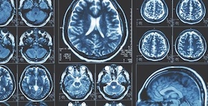 brain image scans